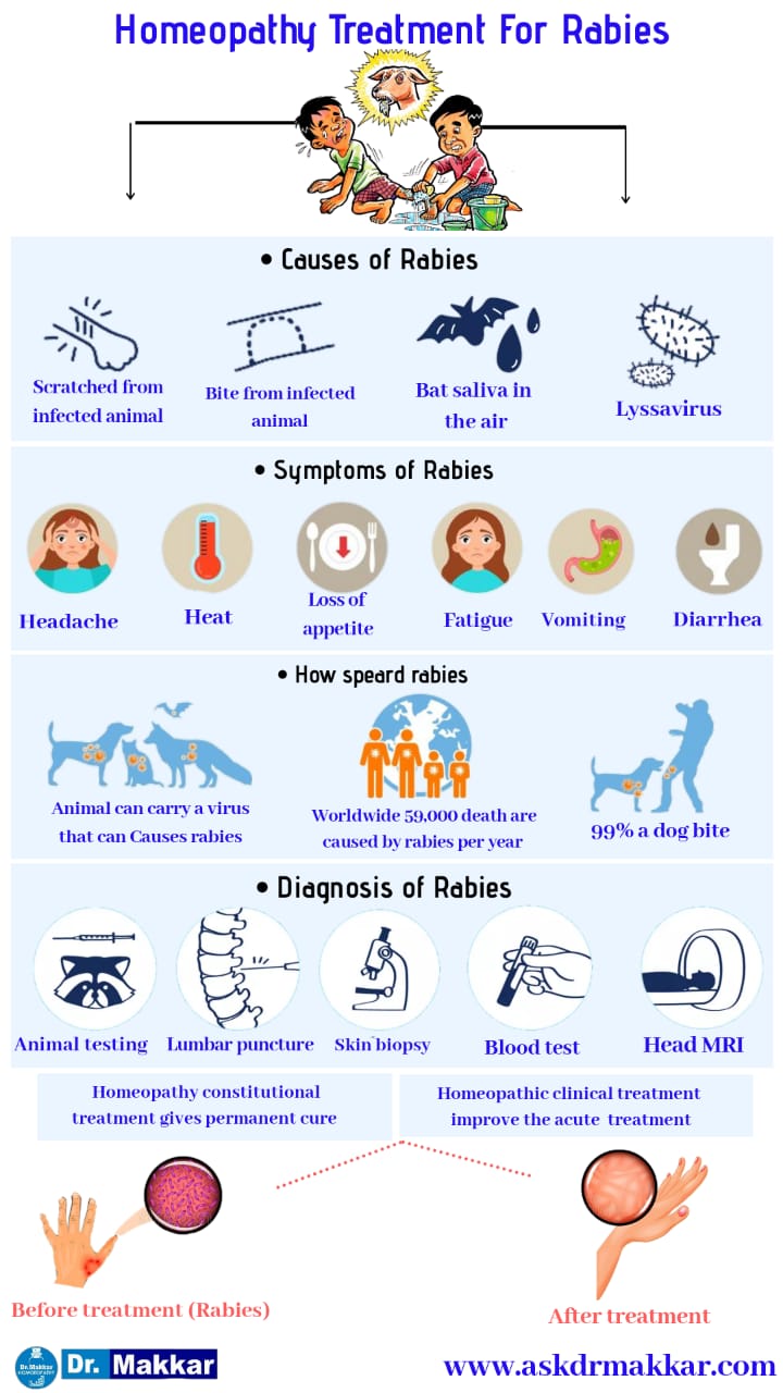 Homeopathy Treatment For Rabies. Homeopathic Medicine Approach Cause ...